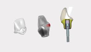 [CADIA] CAD-Service, Implant Abutment